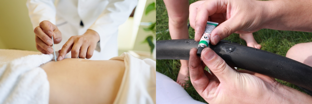 【漢字】「治す」と「直す」の違い・使い分け